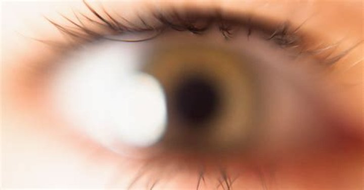 Can you lose eye sight from a stroke?