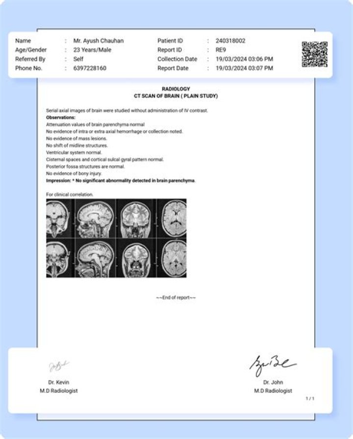 Do you have to report receiving a gift?