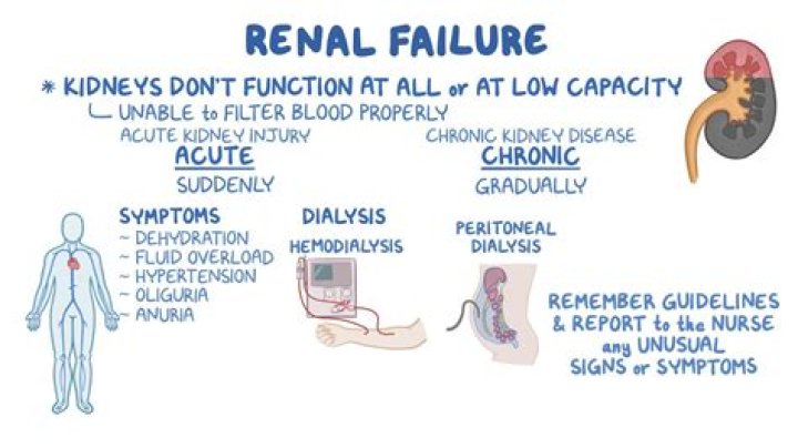Do you need a new kidney if you have kidney failure?