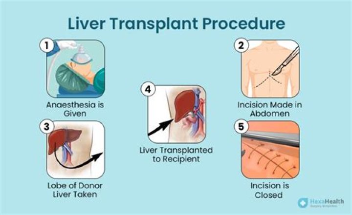 How long are you in the hospital for a liver transplant?
