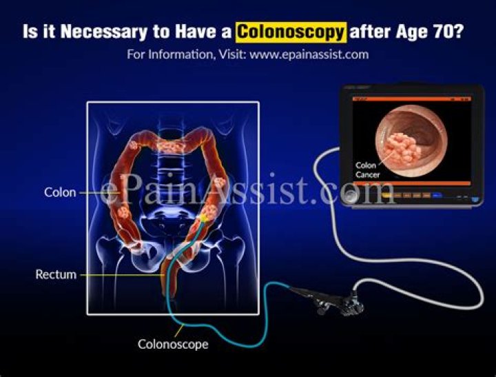 Is it necessary to have a colonoscopy after age 70?