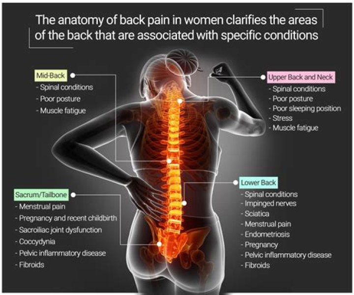 What causes severe back pain in females?
