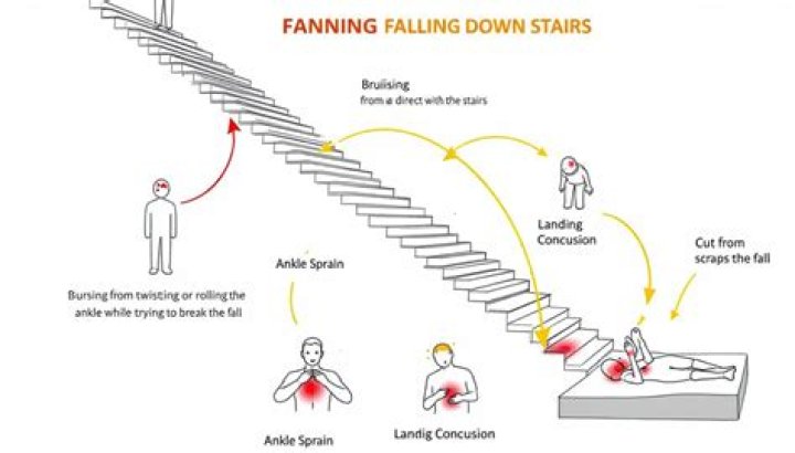 What happens if you fall down stairs?