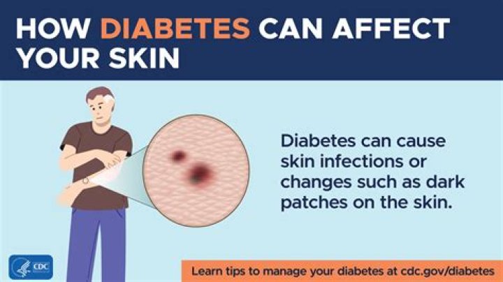 What is a diabetic person?