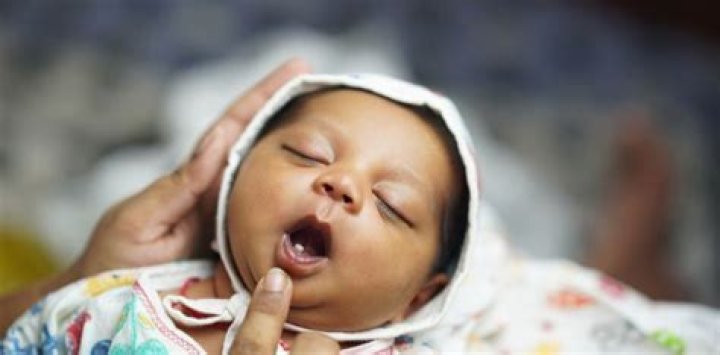 What is it called when a baby is born months early?